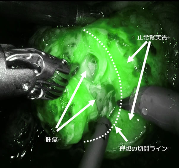 蛍光造影カメラ 写真
