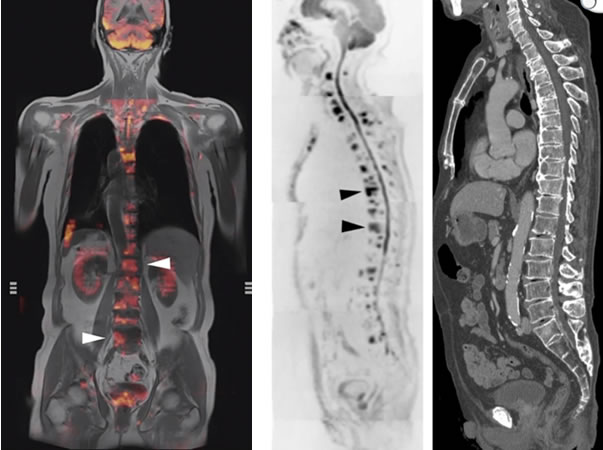 全身MRI 写真